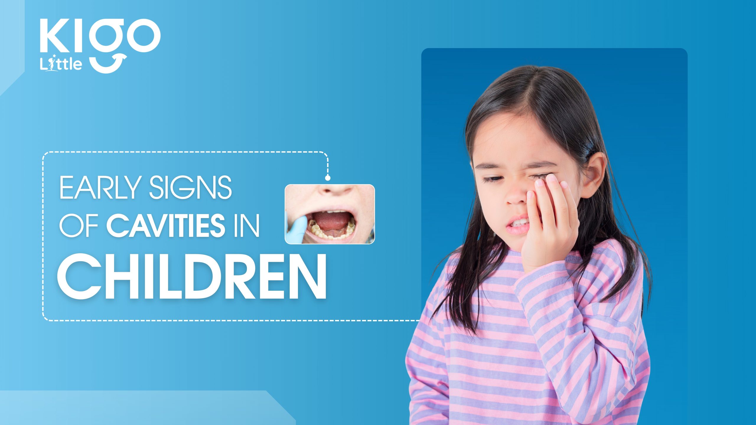 early signs of cavities in children