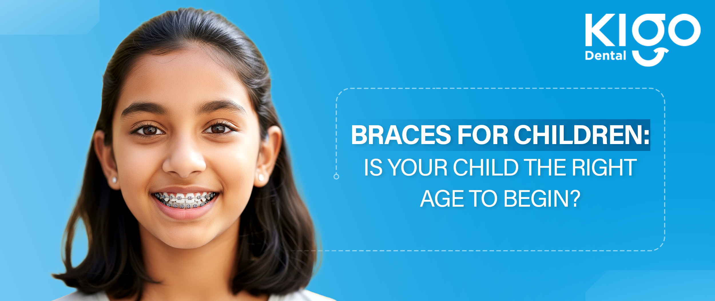 Braces-for-Children-Is-Your-Child-the-Right-Age-to-Begin