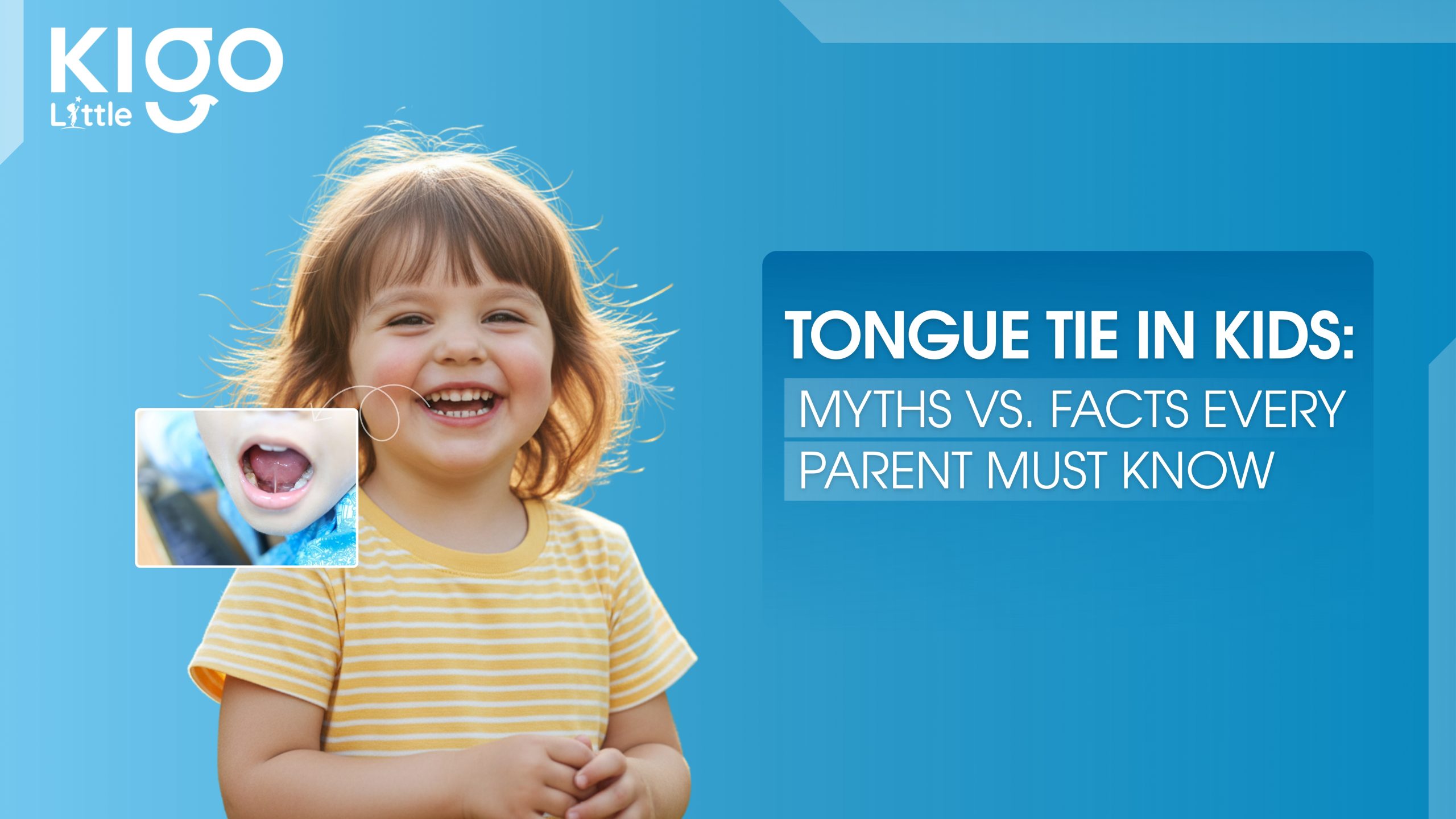 tongue tie in kids Myths vs. facts every parent must know
