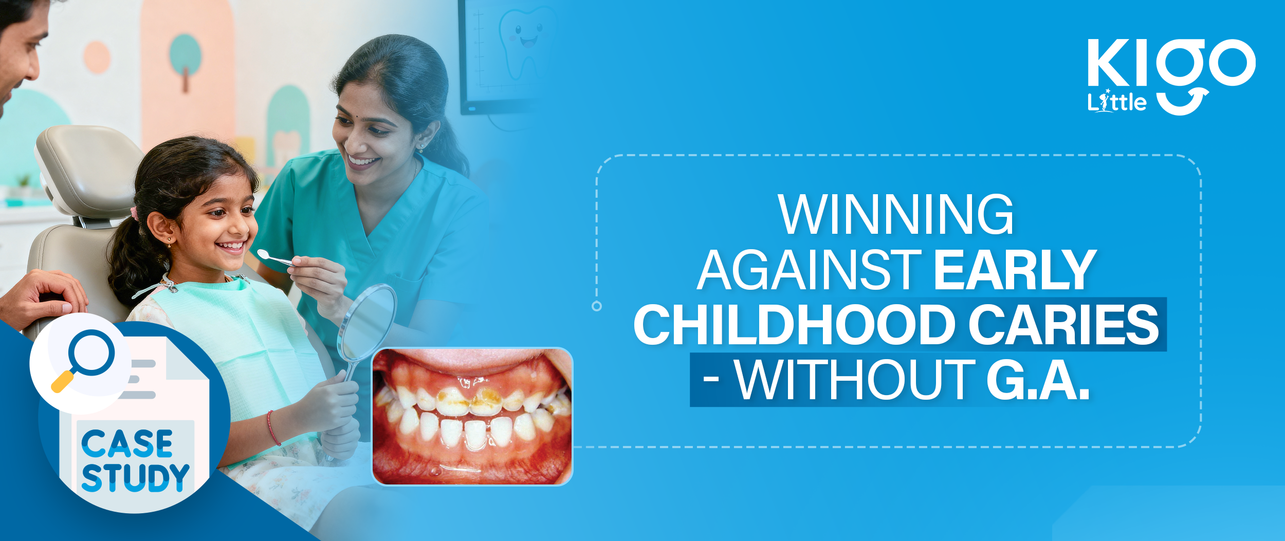 pediatric dental care in Hyderabad