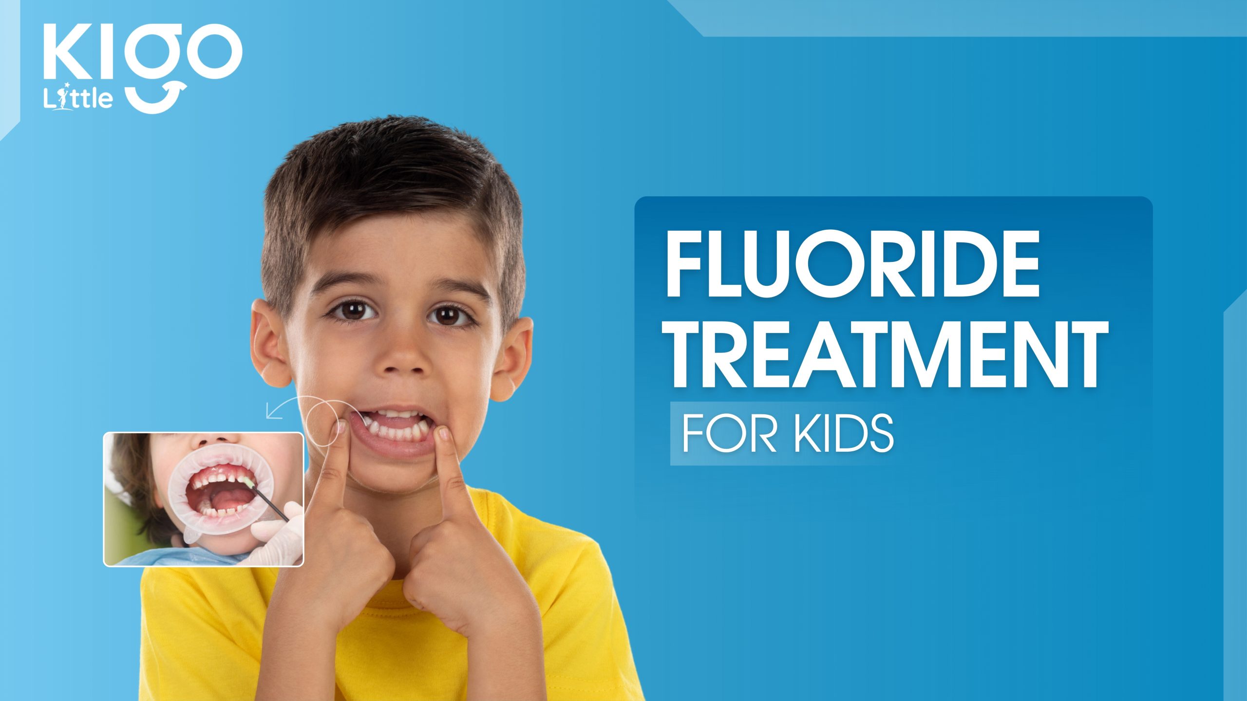 fluoride treatment for kids