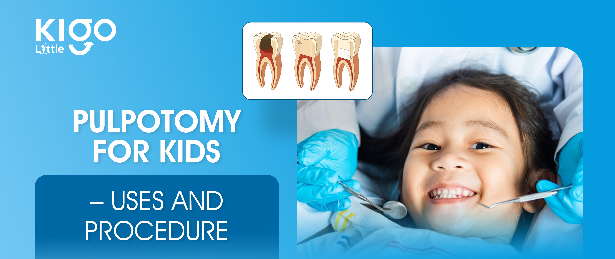 pulpotomy for kids