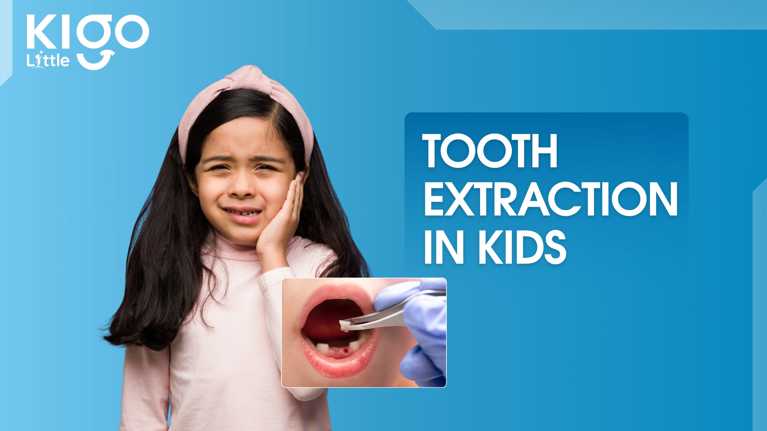 tooth extraction in kids